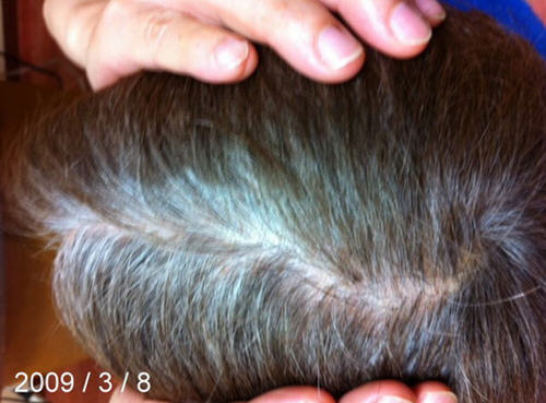 中医推荐黑豆水让你的白发变成黑发，增加头发数量